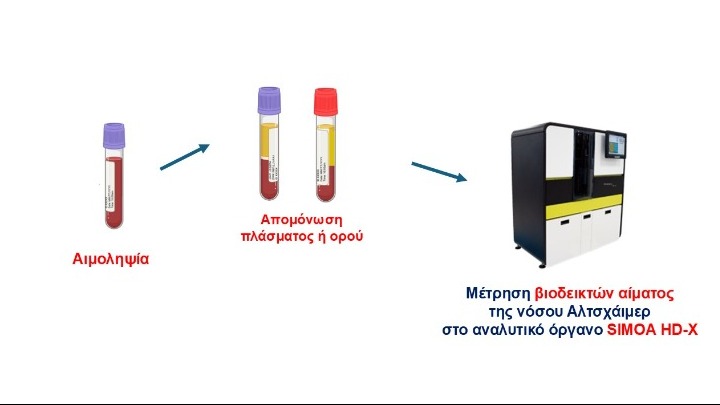 Αλτσχάιμερ, Διάγνωση της νόσου Αλτσχάιμερ, Αλτσχάιμερ (άνοια)